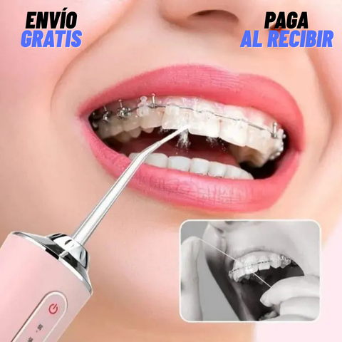 OralCleaner™ - Irrigador Bucal de Limpieza
